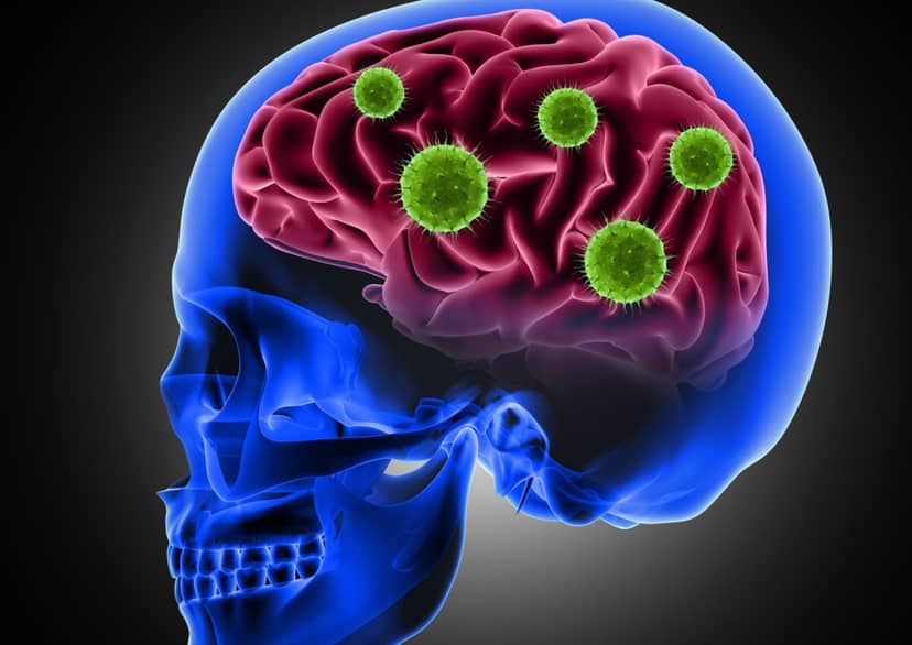 Wirusy, które budzą demencję. Nieoczekiwany duet może prowadzić do choroby Alzheimera