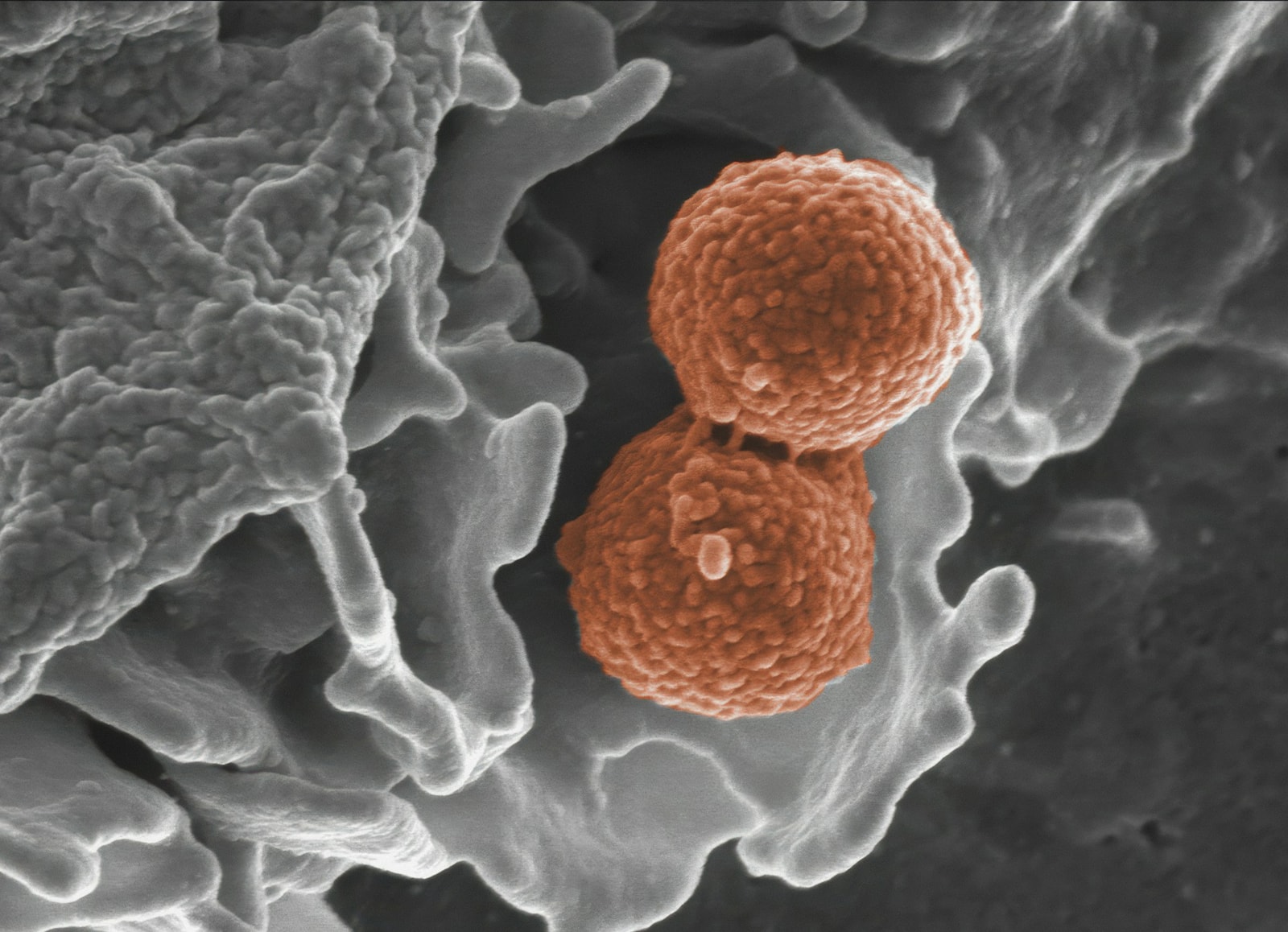 Staphylococcus aureus /Fot. Unsplash
