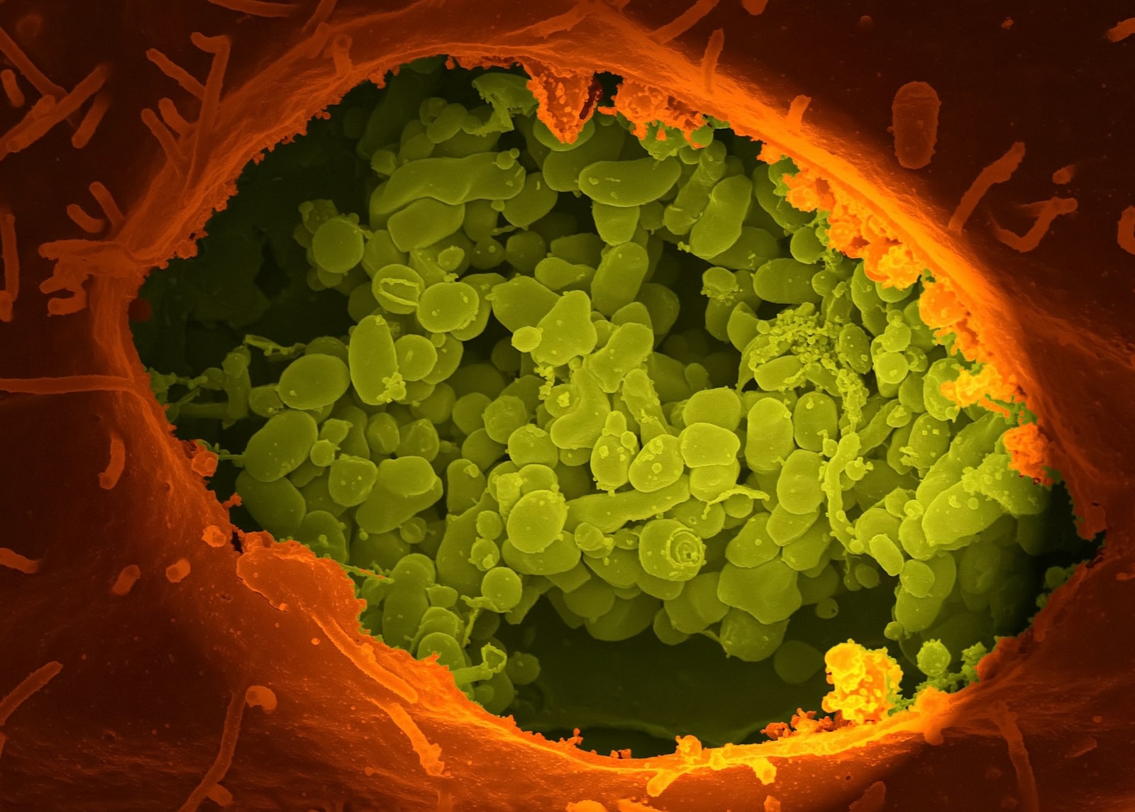 Bakterie Coxiella burnetii wywołujące gorączkę Q – zdjęcie poglądowe /Fot. Unsplash