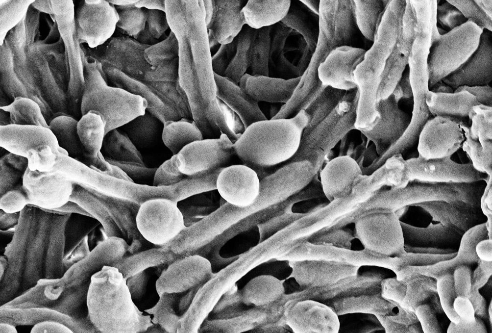 Grzyb Candida albicans – zdjęcie poglądowe /Fot. Wikimedia Commons