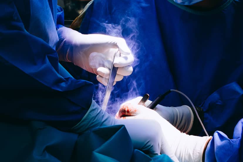 Własne ścięgno zamiast implantu. Lekarze z Lublina dokonali medycznego przełomu